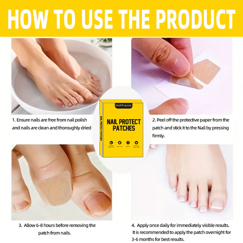 88PCS 갈색 발톱 패치 스티커, 발톱용 네일 스티커 - Nail Care Kit Mens 리뷰 및 가격